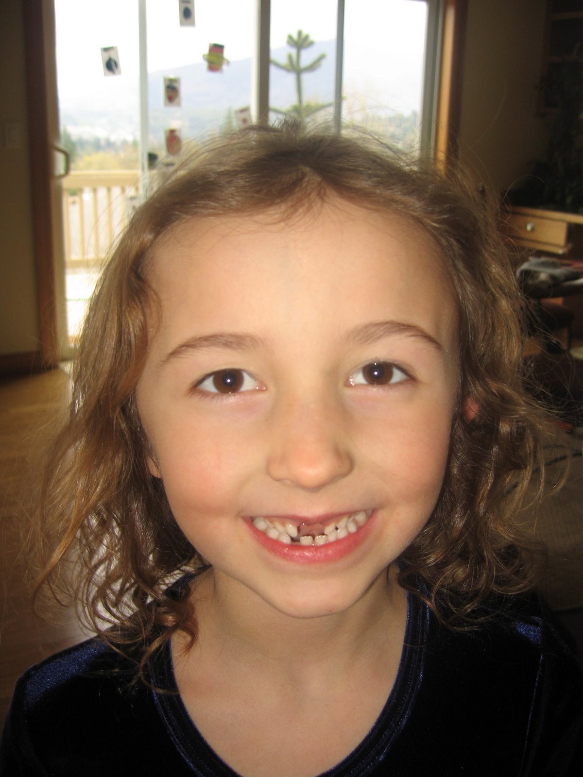 Monti’s new smile